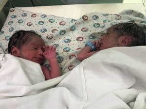 Healthy twins delivered by emergency C-Section at Hospital Nacional Retalhuleu